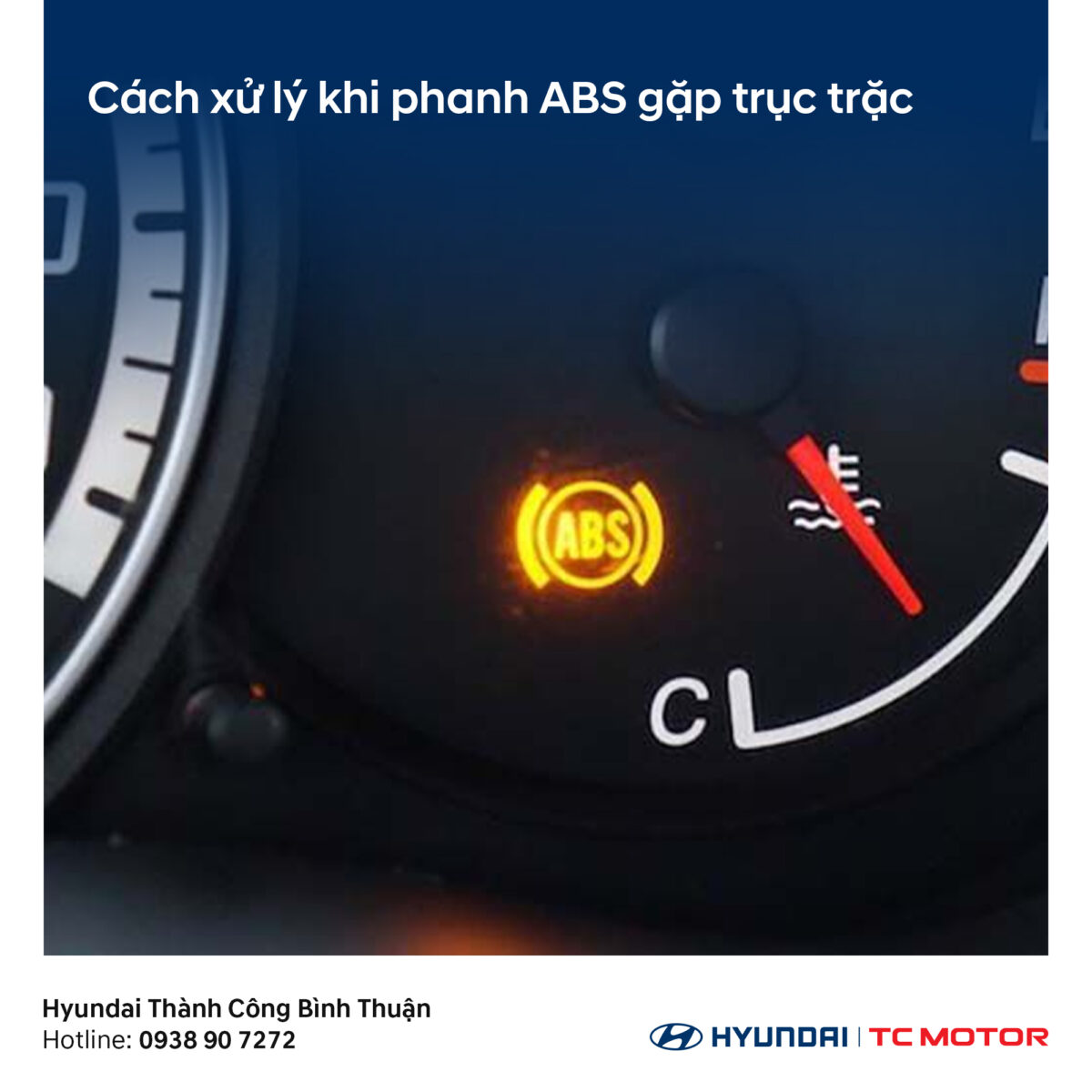 Cách Chỉnh Phanh Xe Máy Đúng Kỹ Thuật: Hướng Dẫn Chi Tiết Từ Chuyên Gia 4 Cách Chỉnh Phanh Xe Máy Đúng Kỹ Thuật: Hướng Dẫn Chi Tiết Từ Chuyên Gia