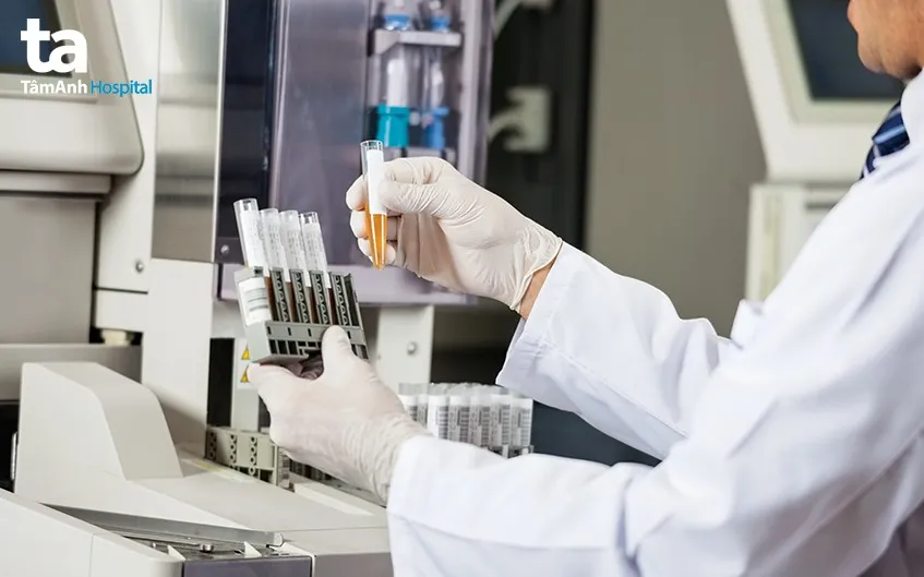 Hình ảnh minh họa quá trình chẩn đoán đi tiểu ra máu, bao gồm lấy mẫu xét nghiệm nước tiểu và chẩn đoán hình ảnh